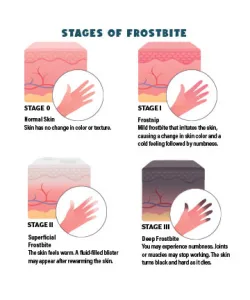 Cold-Weather Health Emergencies